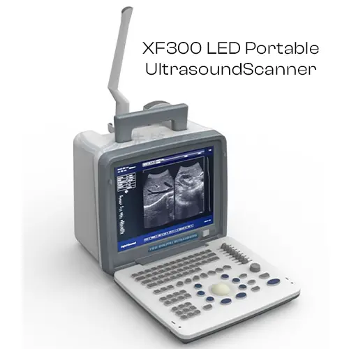 xf300-led-portable-ultrasound-scanner