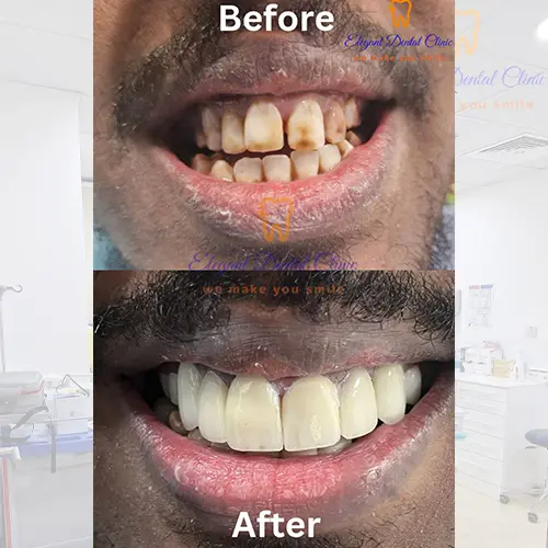 dental-care.webp