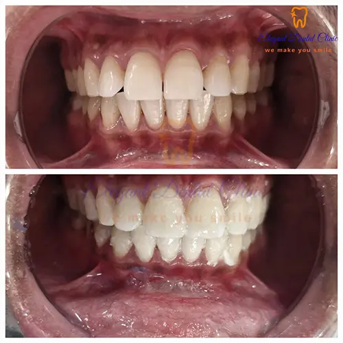 dental-checkup.webp