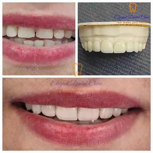 dental-emergency-services.webp