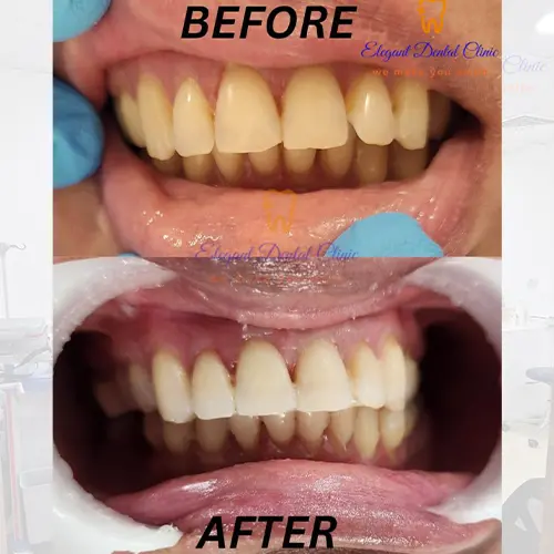 dental-health-checkup.webp